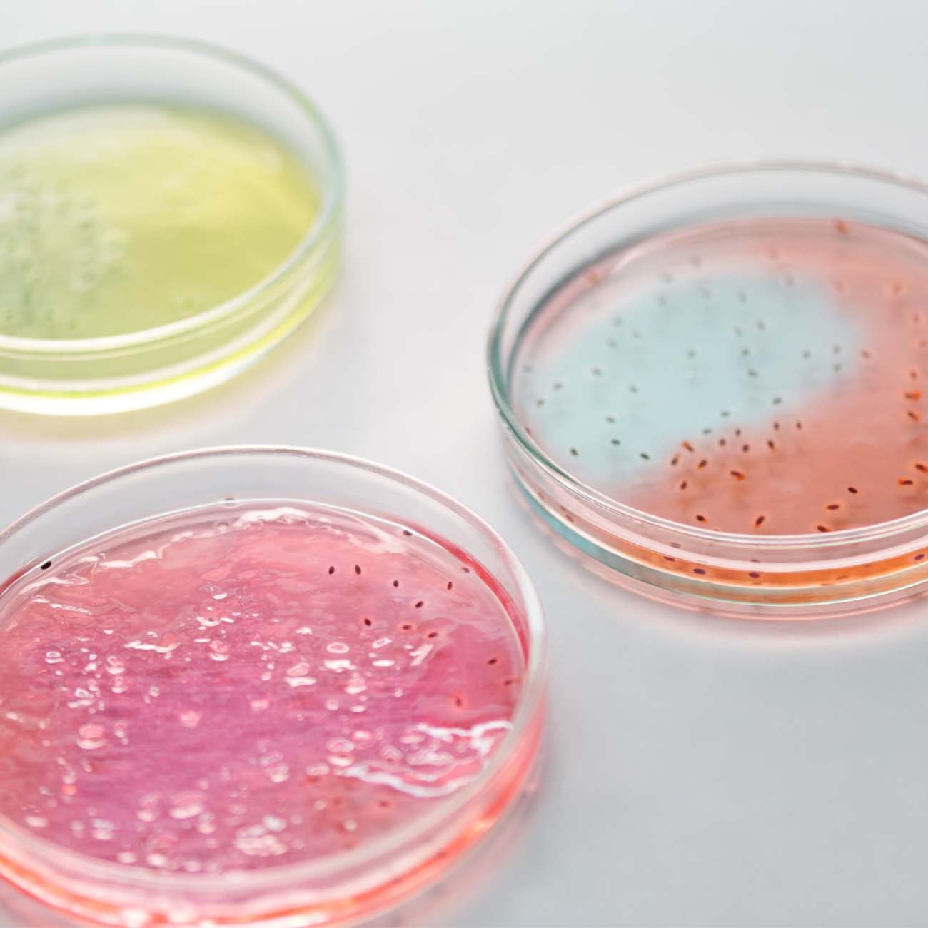 A collection of petrie dishes with a variety of bacteria growth in pinks and yellows